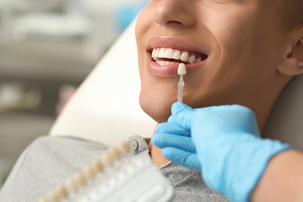 Porcelain Vs  Composite Veneers: Which Is Best For You?