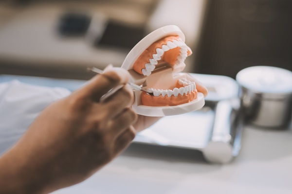 How Long Dentures May Last