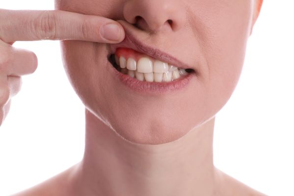 Gum Disease Treatment Options From A Family Dentist To Protect Your Teeth And Gums