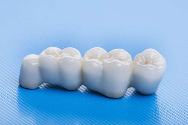 How Many Teeth Can Dental Bridges Replace