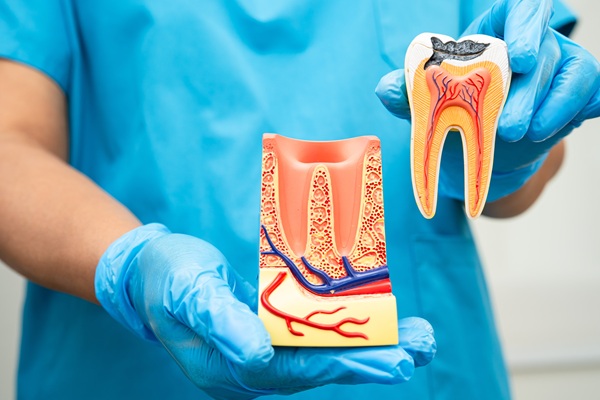 The Importance Of Implant Restoration