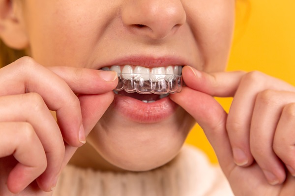 Ideal Candidate Traits For Invisalign Therapy