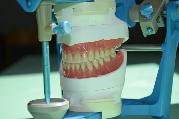 Partial Dentures: A Functional And Aesthetic Solution For Missing Teeth