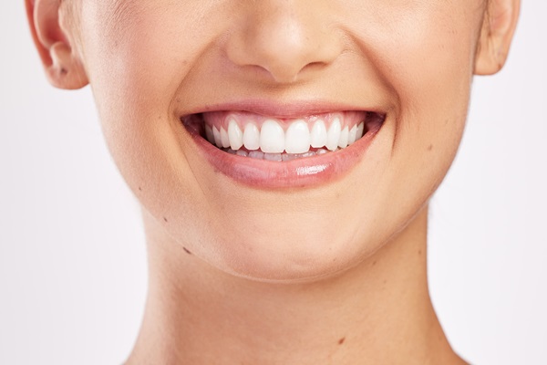 Safety Of Teeth Whitening