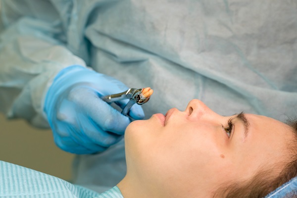 What To Expect During A Tooth Extraction: A Guide To A Smooth Recovery