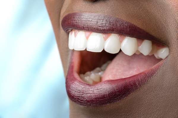 Routine Dental Care: What Are Tooth Colored Fillings from Prince William Dental in Gainesville, VA